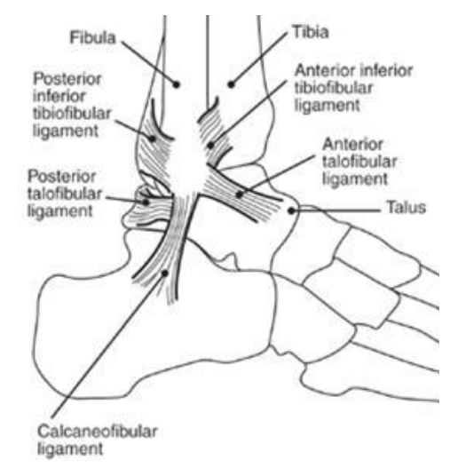 Ankle Sprain - The above diagram shows the ligaments on the outside of the foot. These ligaments could be stretched or torn when you twist your ankle.