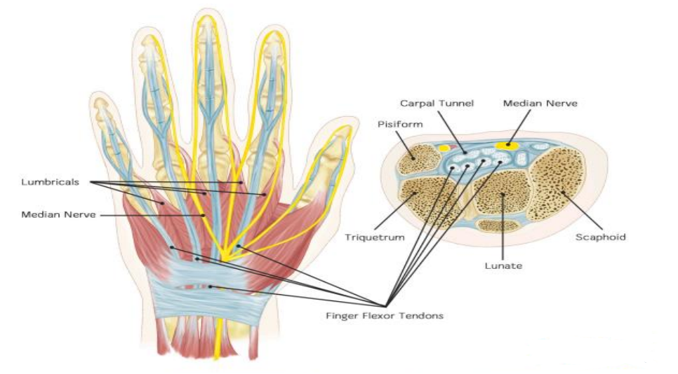 Carpal Tunnel Syndrome (CTS)