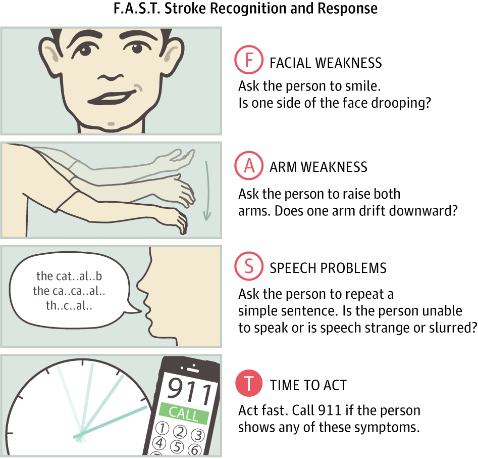 Recover from stroke with expert neuro rehab. Improve mobility, strength, and independence with PhysioElm's stroke recovery physiotherapy. Book a consultation today.
