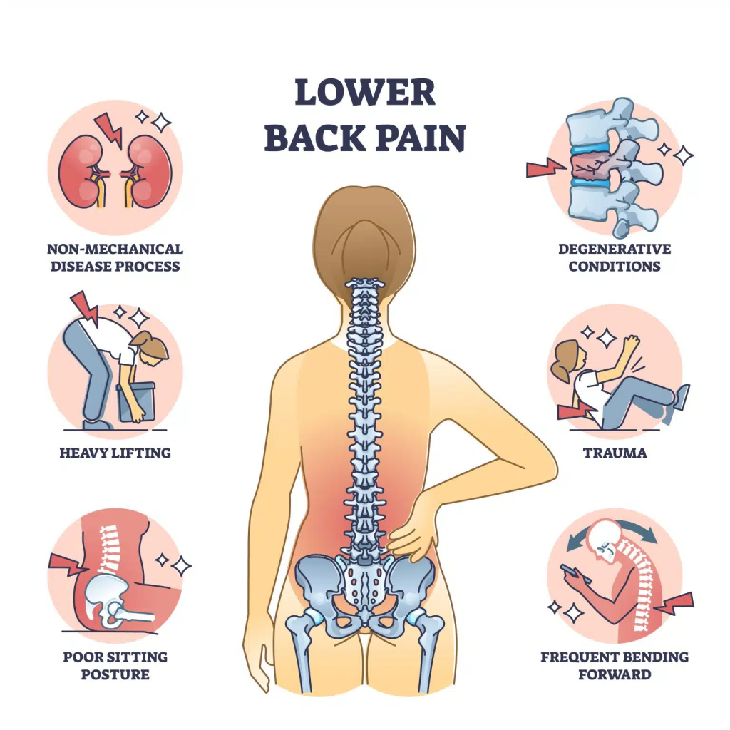 Lower Back Pain : Discover expert-backed treatments for low back pain, muscle strain, and pain relief. 