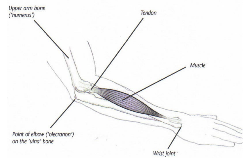 Tennis Elbow Pain Relief